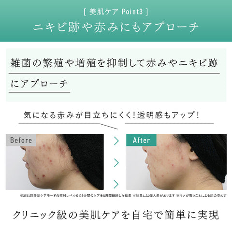 2024年Newモデル》STELLA BEAUTE IPL&LED光美容器(ステラ ボーテ)