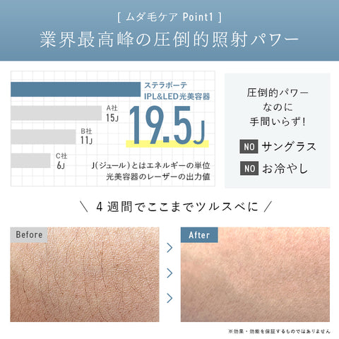 2024年Newモデル》STELLA BEAUTE IPL&LED光美容器(ステラ ボーテ)