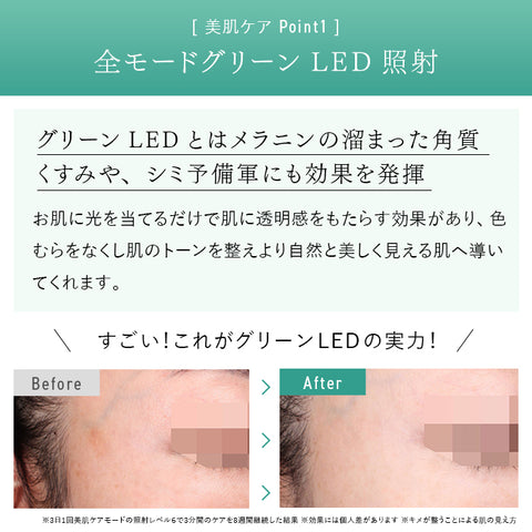 2024年Newモデル》STELLA BEAUTE IPL&LED光美容器(ステラ ボーテ)